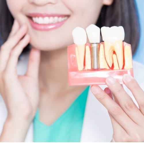 Woman holding up dental implant model